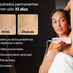 SkinUp Pro | Láser Permanente