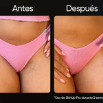 SkinUp Pro | Láser Permanente